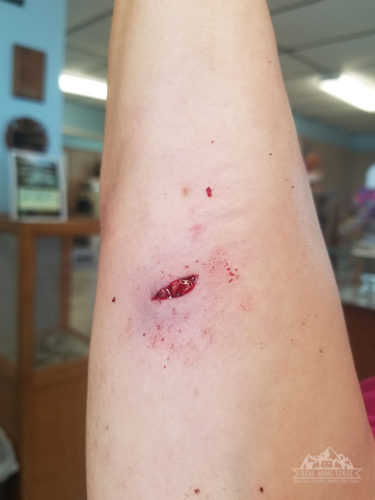 My dog bite wound after it was cleaned